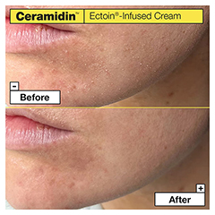 DR.JART+ Ceramidin Ectoin-Infused Cream 50 Milliliter - Info 2